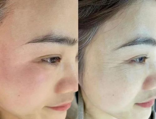 子好？分享：用户评价最高的几款产品凯发K8登录入口抗皱纹抗衰老哪个牌(图6)