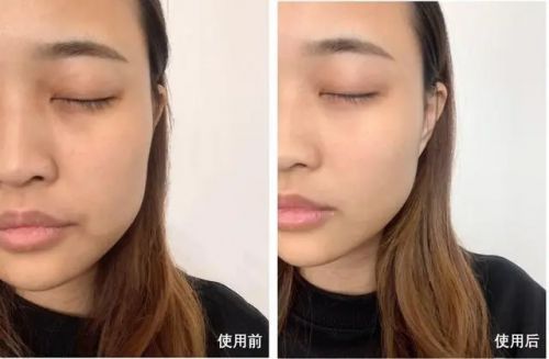 品抗皱好？让肌肤焕发新生凯发k8一触即发哪种护肤(图6)