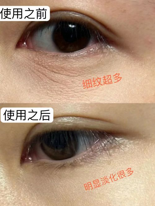 子好？分享五款适合男士使用的眼霜凯发天生赢家25岁男士眼霜哪个牌(图1)