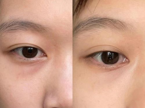 强！眼霜攻略分享十大淡纹排行推荐凯发k8国际抗皱眼霜排行榜前十(图10)