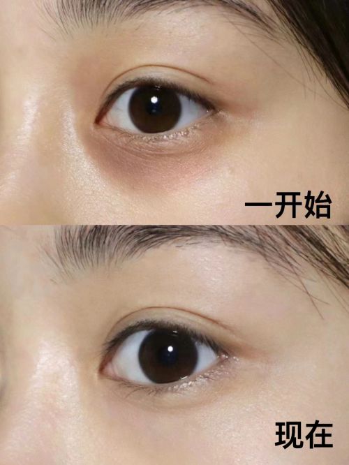 ！2025温和抗皱眼霜分享榜单前十凯发K8旗舰厅抗皱眼霜排行榜前十强(图12)
